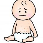突発性発疹で熱が出ない時の対処法!保育園はいつから行ける?
