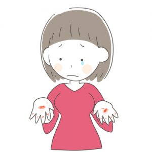 しもやけに効く市販薬5選！