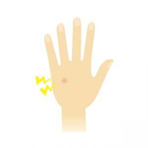 手の甲がかゆい3つの原因と対処法！