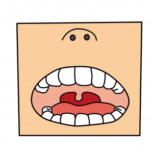 喉に白い斑点ができる5つの原因と対処法!