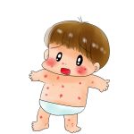 あせもの治し方5つのポイントを紹介!