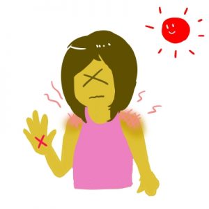 日焼けによるかゆみの４つの対処法とオススメの市販薬！