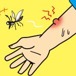 蚊アレルギーの症状と対策!治療法や薬についても解説します