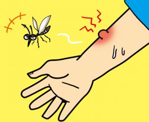蚊アレルギーの症状と対策!治療法や薬についても解説します