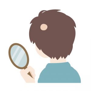 円形脱毛症の原因はシャンプー？ストレス？女性や子供の場合は？