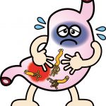 胃潰瘍の主な4つの症状とは？治療法や薬も紹介！