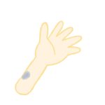青あざになる3つの原因と3つの治し方!こんな病気の可能性も!