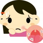 【決定版】口内炎を早く治す11の方法!定番から裏技まで完全網羅!