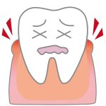 歯茎がかゆい9つの原因と対処法!