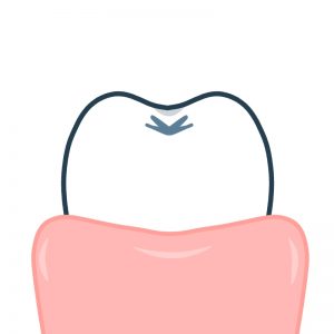【保存版】歯茎が白い8つの原因と対処法!